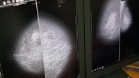 В городской поликлинике атомного Зеленогорска запустили в работу маммограф