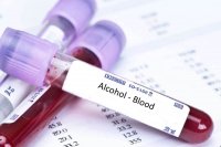 Степень опьянения водителей будут определять по анализу крови