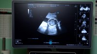 В КБ №42 привезли новый аппарат УЗИ для акушерского и гинекологического осмотра
